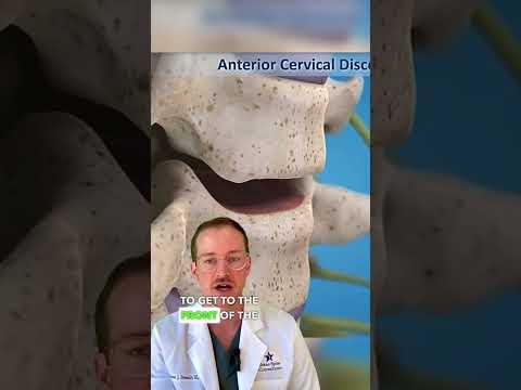 Understanding Pseudoarthrosis in the Cervical and Lumbar Spine