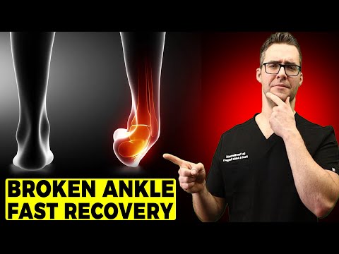 Effective Care Strategies for Ankle Fracture Treatment