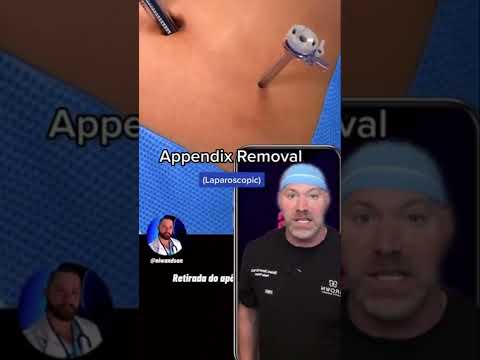 A Fascinating Look at the Appendix in Stunning Detail post thumbnail image