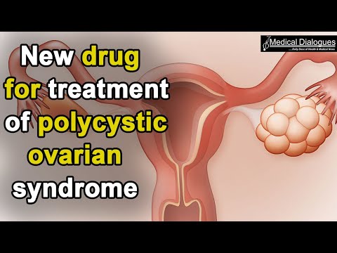 Effective Medications for Managing Polycystic Ovary Syndrome (PCOS)