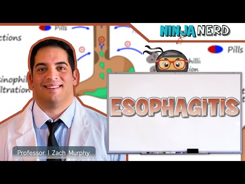 Understanding Erosive Esophagitis: Causes and Treatments post thumbnail image