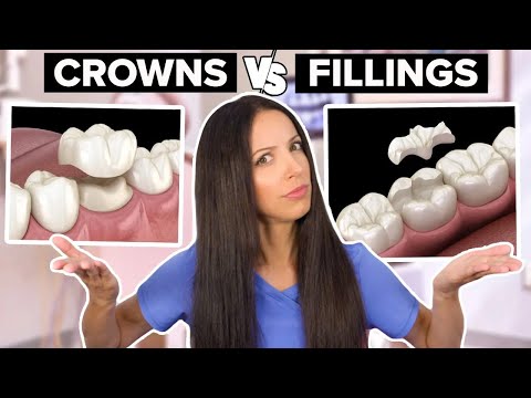 Understanding Dental Crowns: Purpose, Benefits, and Care