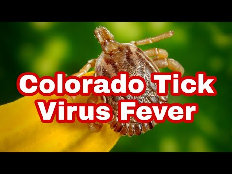 Understanding Colorado Tick Fever: Symptoms and Diagnosis post thumbnail image