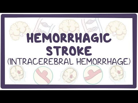 Understanding Intracranial Hemorrhages: Symptoms and Care