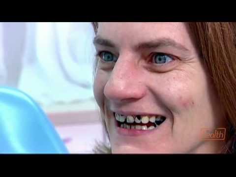 Rotten Teeth in Kids: Signs, Pictures, and Care Insights