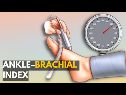 Understanding the Ankle Brachial Index Test for Health Insights