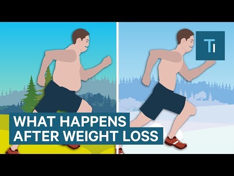 13 Health Risks of Excess Weight and Ways to Stay Healthy