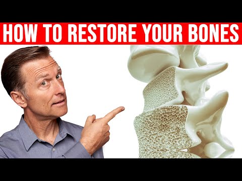 Osteopenia vs. Osteoporosis: Key Differences Explained post thumbnail image