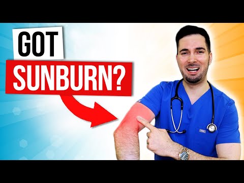 Sunburn vs Hell's Itch: Relief, Prevention, and Insights