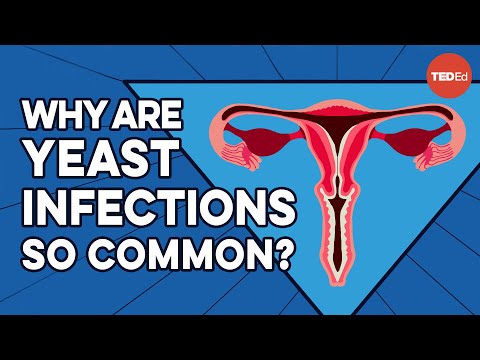 11 Soothing Home Remedies for Vaginal Yeast Infections