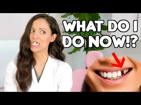 3 Effective Options for Replacing Missing Teeth Safely