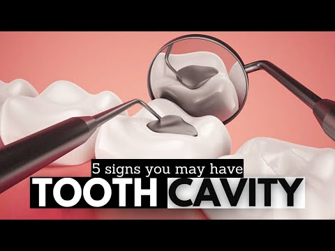 Signs You Might Have a Cavity: What to Look For