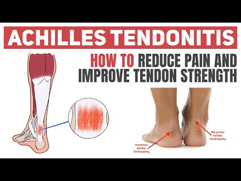 Effective Exercises for Relieving Achilles Tendonitis Pain post thumbnail image