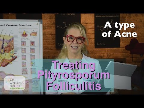 Natural Treatments for Pityrosporum Folliculitis Explained