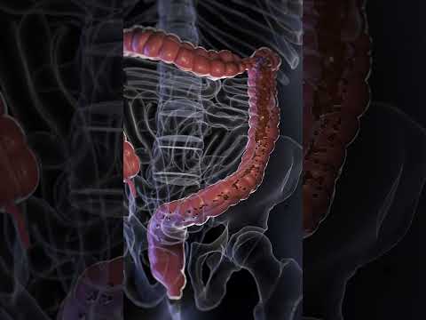 Dysentery Explained: Causes, Symptoms, and Treatment Insights