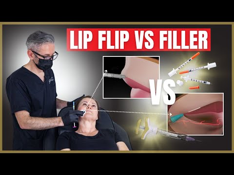 Lip Flip: Costs, Procedure Insights, and Risks Explained post thumbnail image