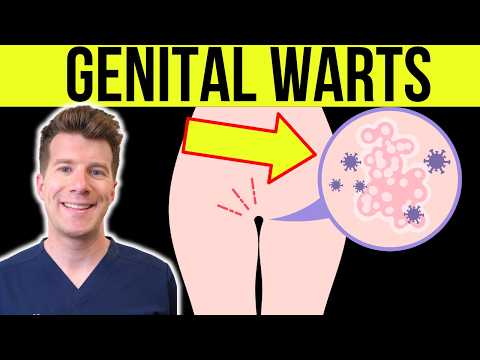 Warts: Types, Images, Treatments, and Helpful Insights