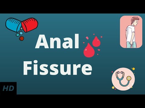 Nipple Fissures: Symptoms, Care, and Preventive Steps