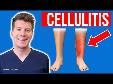 Vivid Images of Skin Infections You Should See