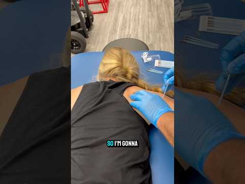 Dry Needling: A Clash of Healing Traditions