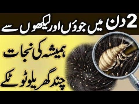 Say Goodbye to Head Lice: Effective Treatments and Remedies