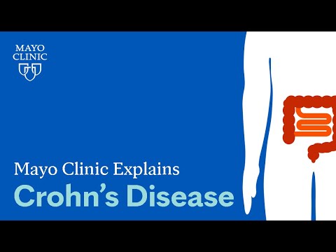 Understanding Crohn's Disease: Symptoms, Risks, and Care