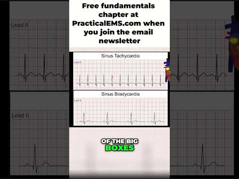 Understanding Sinus Tachycardia: Causes, Symptoms, and Care post thumbnail image