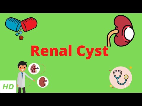 Understanding Kidney Cysts: Symptoms, Causes, and Treatments