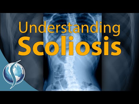 Understanding Spine Curvature Disorders: Causes and Symptoms