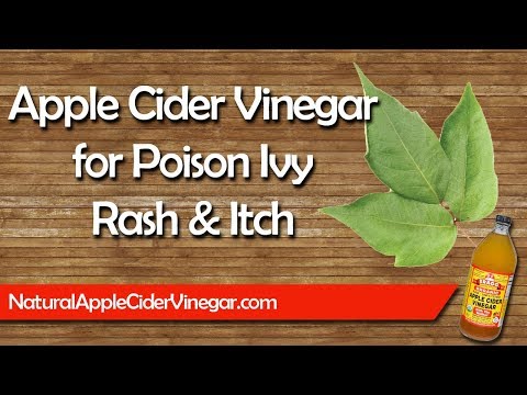 Apple Cider Vinegar for Poison Ivy: Does It Help? post thumbnail image
