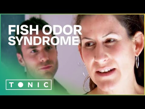 Trimethylaminuria: Understanding Fish Odor Syndrome's Effects
