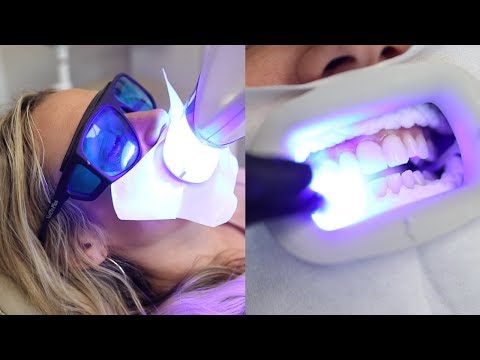 Laser Teeth Whitening: Understanding Costs and Health Benefits