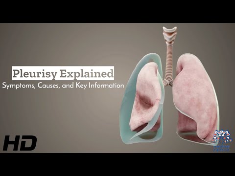 Understanding Pleurisy Duration: What to Expect During Recovery