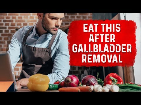 Post-Gallbladder Surgery: Foods You Should Eat and Avoid