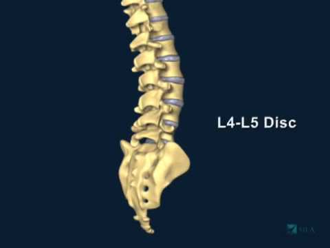 Understanding L4 Lumbar Spine Anatomy for Back Pain Relief