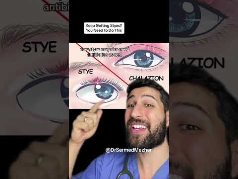 Why Do Styes Happen? Risks and Prevention Strategies