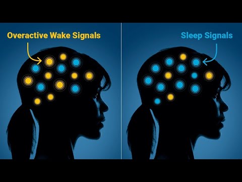 Understanding Quviviq Costs and Its Role in Sleep Treatment