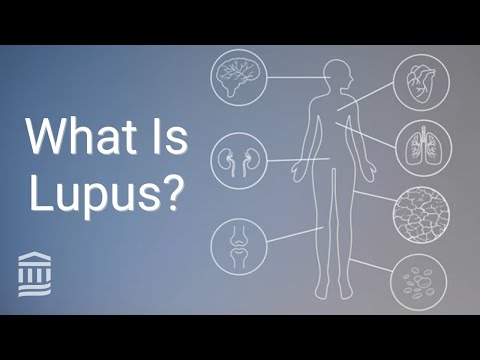 Understanding Lupus: Symptoms, Causes, and Care Tips post thumbnail image