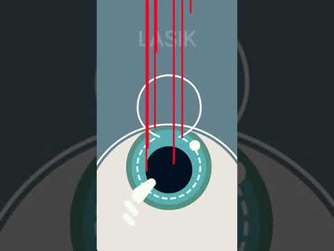 Understanding Different Types of Eye Surgery: A Helpful Overview