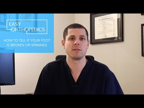 What You Need to Know About Broken Foot Symptoms