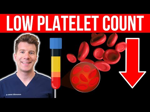 Understanding Thrombocytopenia: Symptoms and Causes Explained