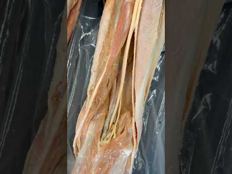 Unraveling the Mystery of Pain Behind the Knee post thumbnail image