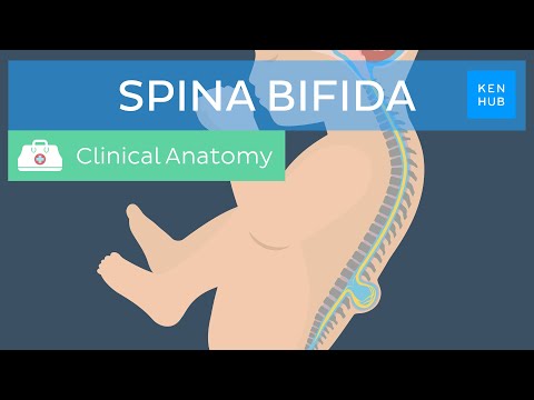 Understanding Spina Bifida: Causes, Symptoms, and Care