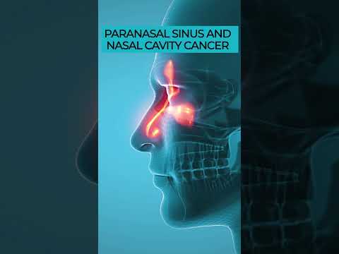 Understanding the Causes and Risk Factors of Sinus Cancer