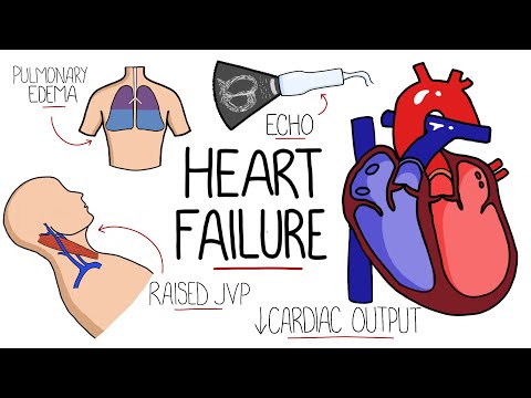Systolic vs. Diastolic Heart Failure: Key Differences Explained post thumbnail image
