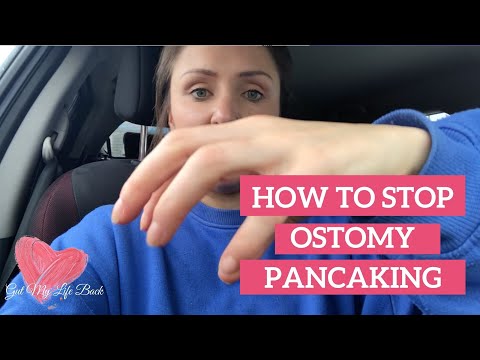 Essential Care Tips for Living With Colostomy Bags post thumbnail image
