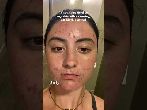 Your 2023 Guide to Birth Control, STIs, and Acne Care