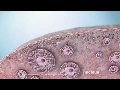 Understanding Germ Cell Cancer: Symptoms, Care, and Treatment