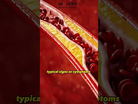 Understanding Arteriosclerosis and Atherosclerosis: Signs & Care
