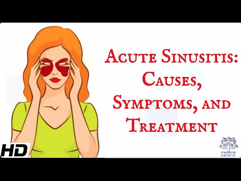 Acute Sinusitis: What You Should Know About Causes and Symptoms post thumbnail image